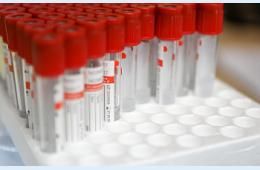 05.05.2022 Более 170 тысяч приморцев переболели COVID-19 за время пандемии, сообщает www.primorsky.ru | Администрация муниципального округа город Партизанск Приморского края Официальный сайт